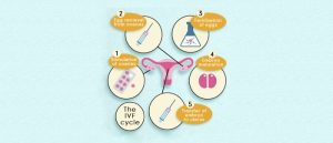 How does IVF Work – An Overview