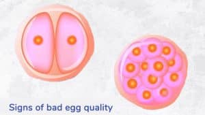 Signs of Poor Egg Quality – Unveiling Symptoms and Causes