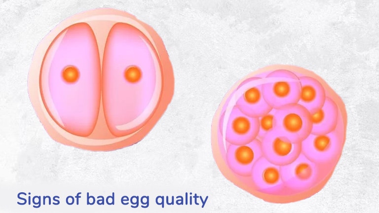 Signs of bad Egg Quality