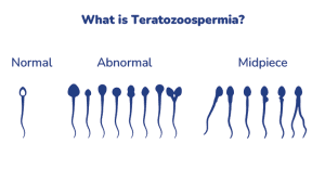 What is Teratozoospermia? A Detailed Guide to Understanding Causes and Symptoms