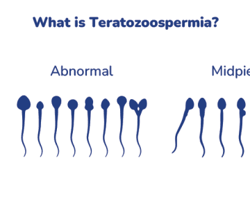 What is Teratozoospermia? A Detailed Guide to Understanding Causes and Symptoms